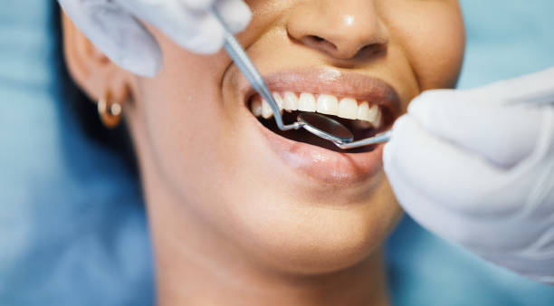 Best Emergency Wisdom Teeth Removal in Badger, AK